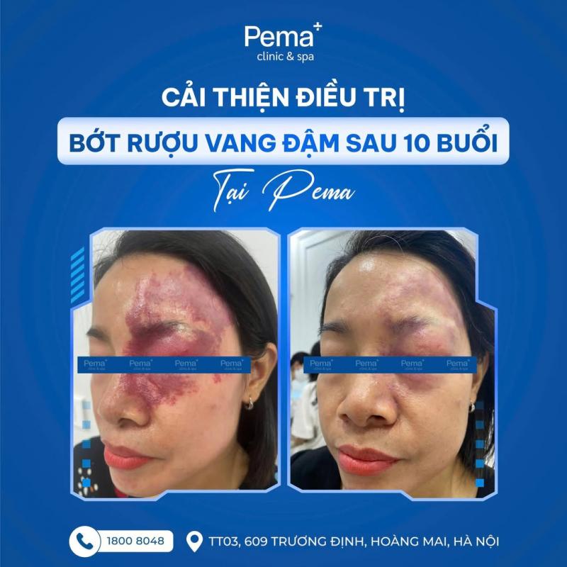 Phòng Khám Da liễu và Thẩm mỹ PEMA