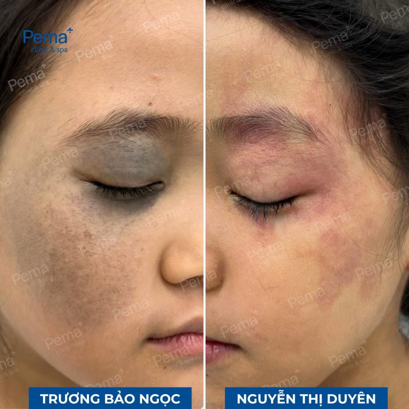 Phòng Khám Da liễu và Thẩm mỹ PEMA