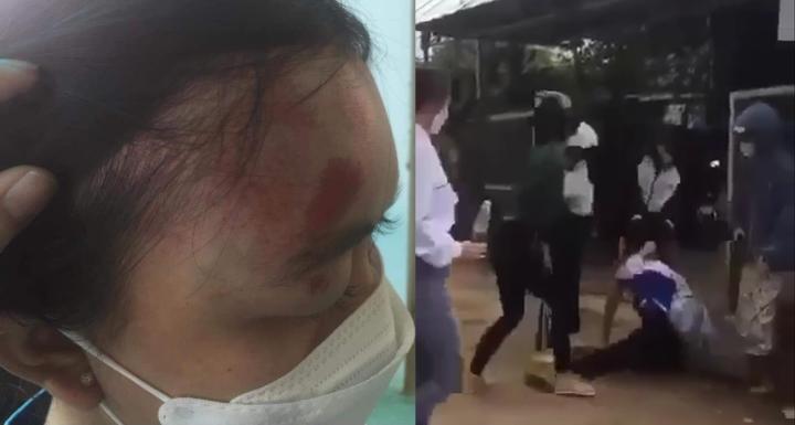 Nữ sinh lớp 11 bị đánh hội đồng ở Lâm Đồng - ảnh: VTC News