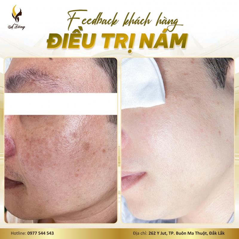 Á Đông Clinic & Spa