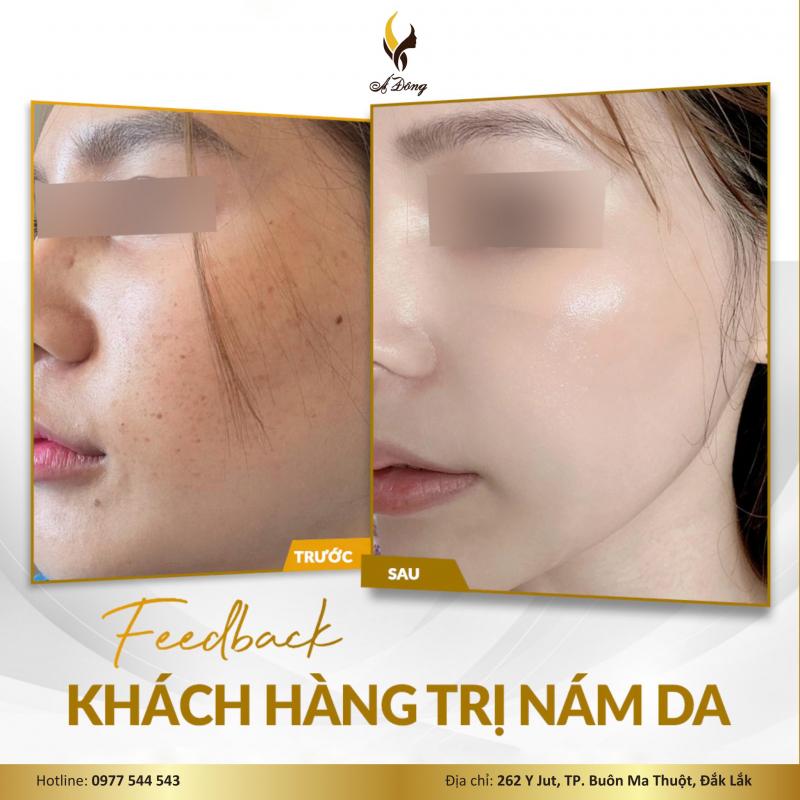 Á Đông Clinic & Spa