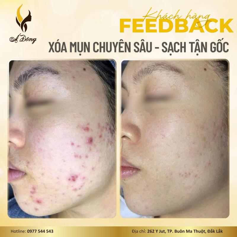 Á Đông Clinic & Spa