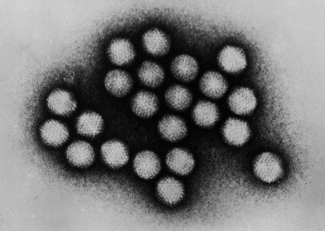 Adenovirus dưới kính hiển vi điện tử