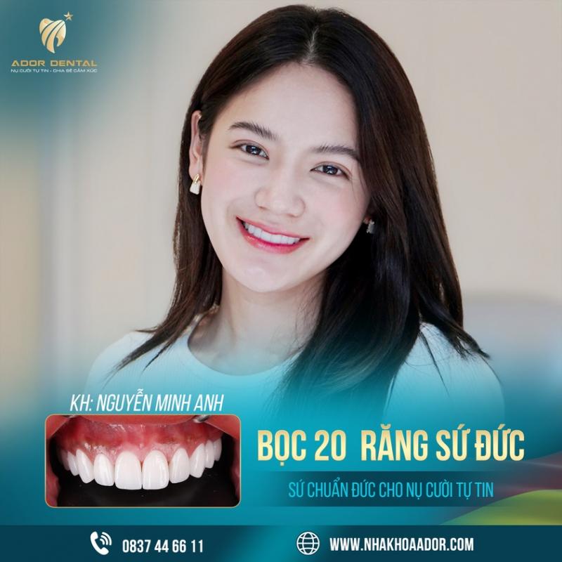 ADOR Dental- Long Xuyên