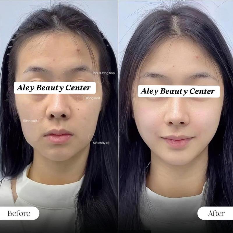 Aley Beauty Center