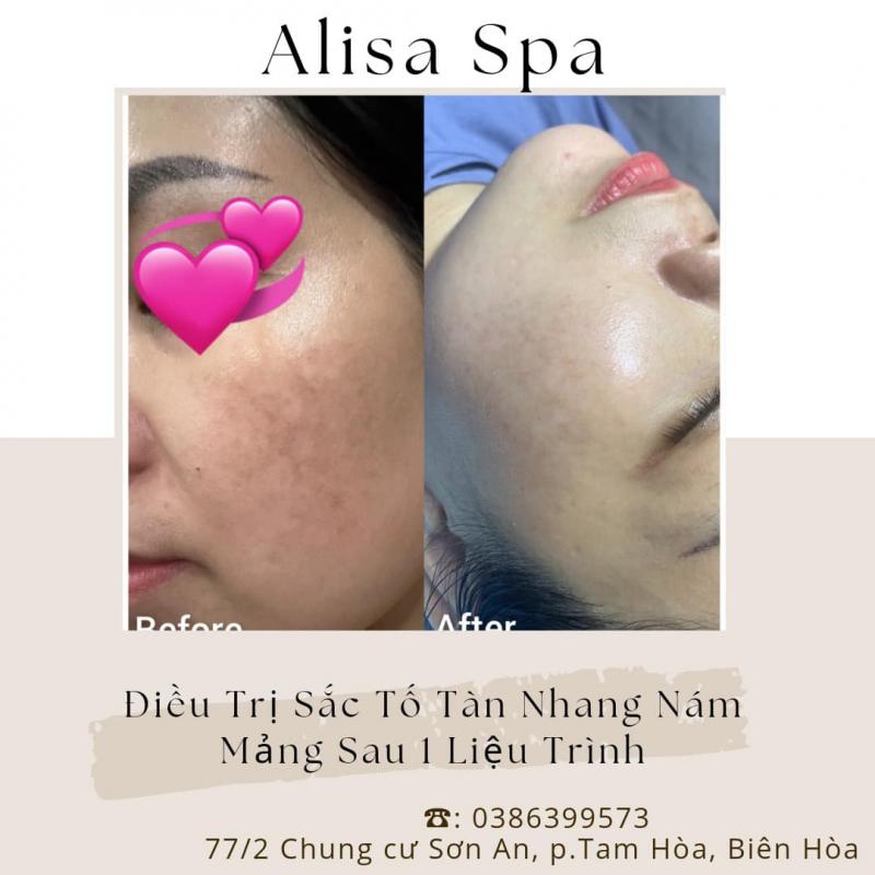 Alisa Spa Biên Hòa