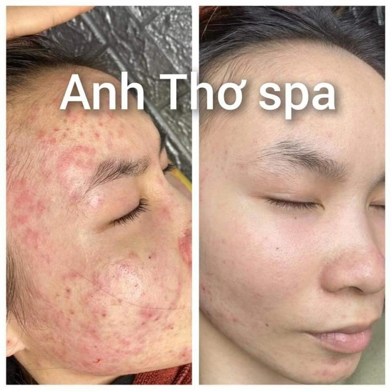 Anh Thơ Spa