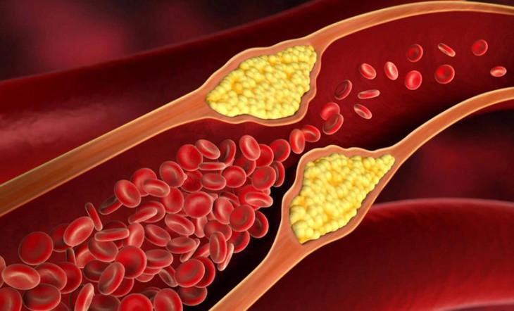 Hình ảnh minh hoạ Cholesterol