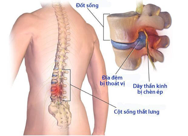 Tiến sĩ, Bác sĩ Chuyên khoa II Trần Quang Hiển chuyên khám cột sống