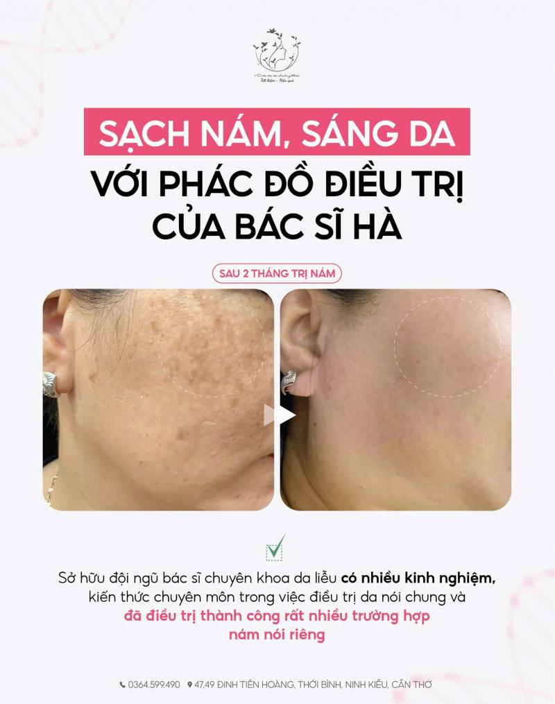 Bác Sĩ Ngọc Hà - Da Liễu Thẩm Mỹ