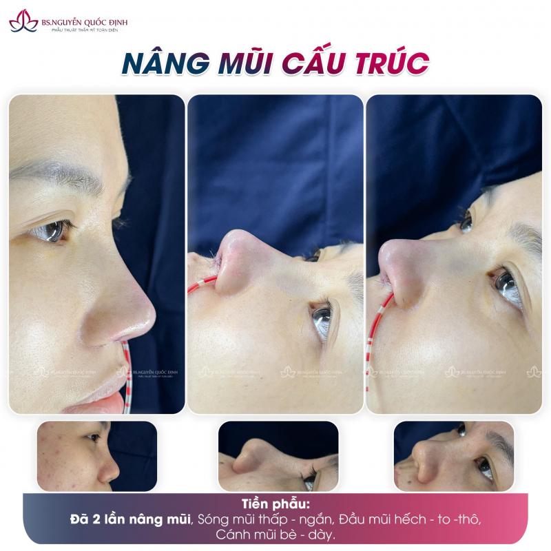 Bác Sĩ Nguyễn Quốc Định