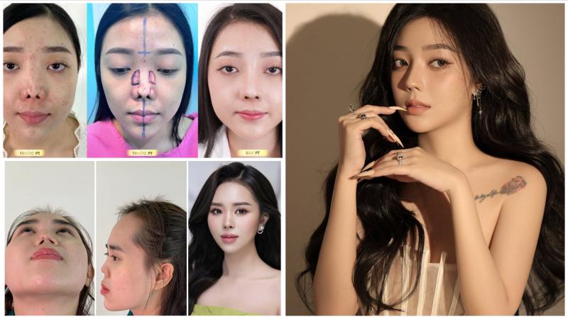 Bác sĩ Nguyễn Tiến Huy – Bậc thầy sửa mũi hỏng, mũi khó tại Phòng khám Thẩm mỹ Sài Gòn Venus