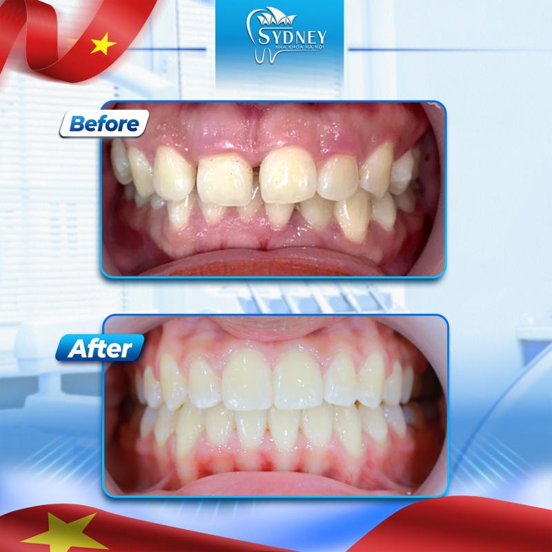Trung Tâm Nha khoa Hanoi Sydney