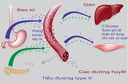 Loại bệnh khi ăn tối muộn