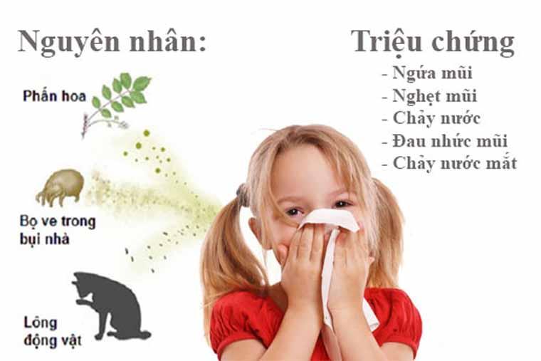 Bệnh viêm mũi dị ứng ở trẻ