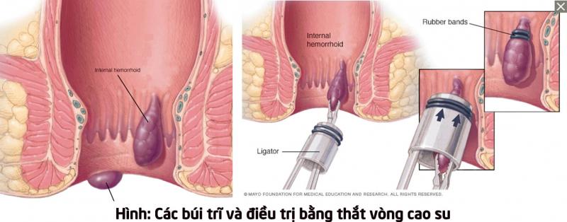 Bệnh viện 108