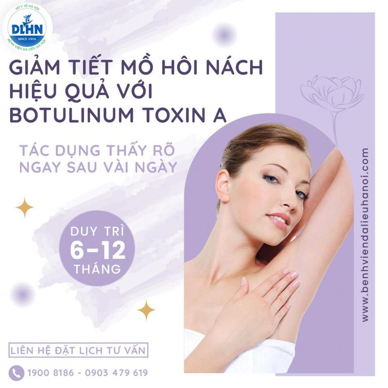 Tiêm Botox điều trị hôi nách