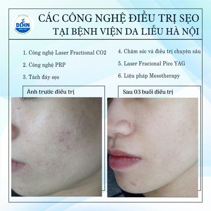 Bệnh Viện Da Liễu Hà Nội