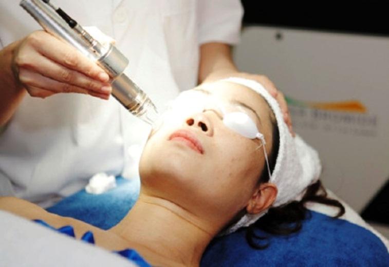 Bác sĩ điều trị nám cho bệnh nhân bằng công nghệ Laser