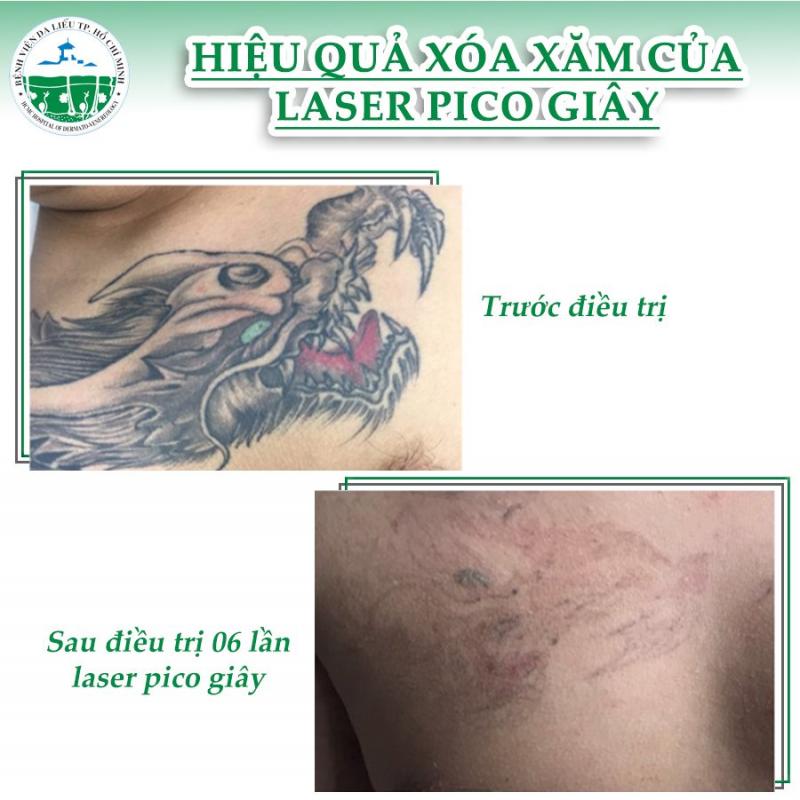 Bệnh viện Da liễu TPHCM