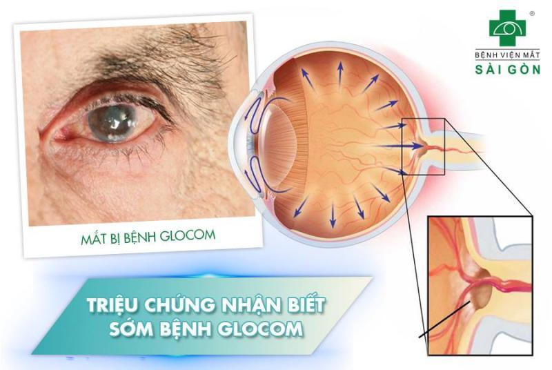 Bệnh viện Mắt Sài Gòn Hà Nội