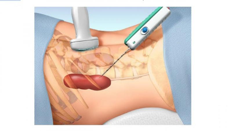 Bệnh viện Pháp Việt