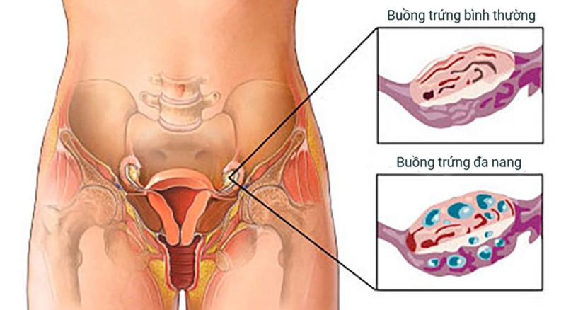 Bệnh viện Phụ sản MÊKÔNG