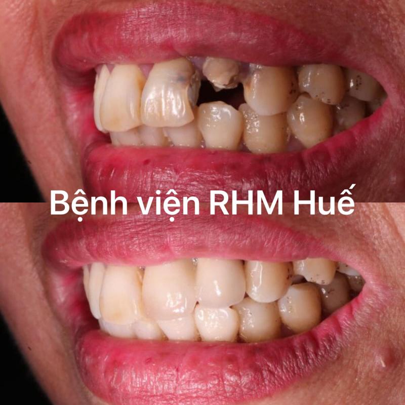 Bệnh viện Răng Hàm Mặt Huế