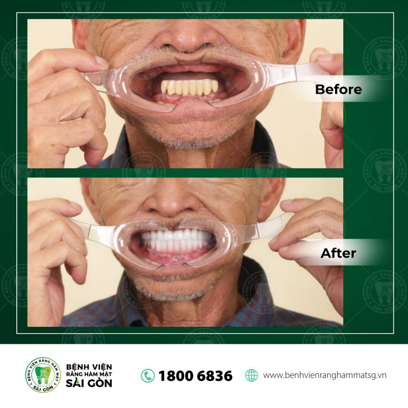 Bệnh Viện Răng Hàm Mặt Sài Gòn