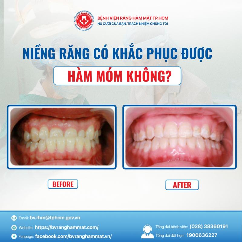 Bệnh viện Răng Hàm Mặt TP.HCM