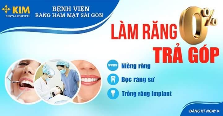 Bạn có thể làm răng với phương thức trả góp