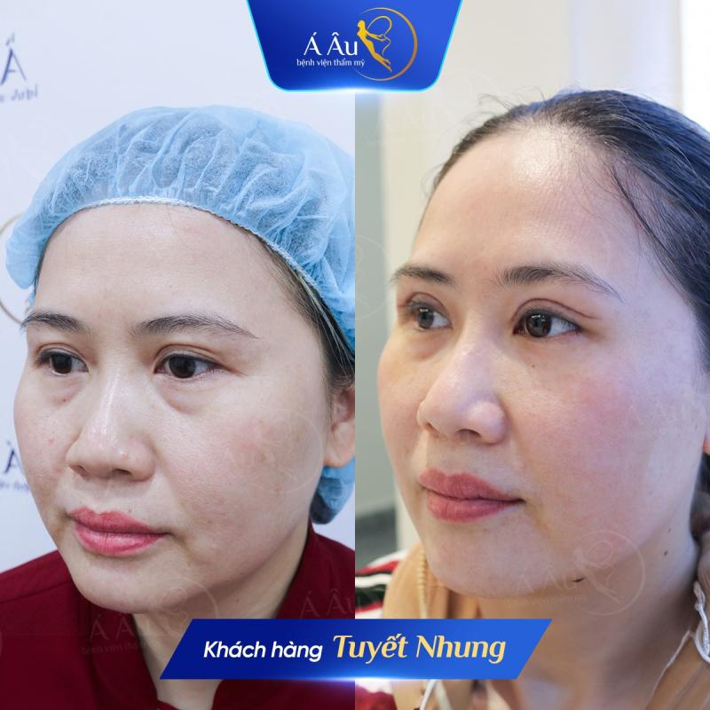 Bệnh Viện Thẩm Mỹ Á Âu