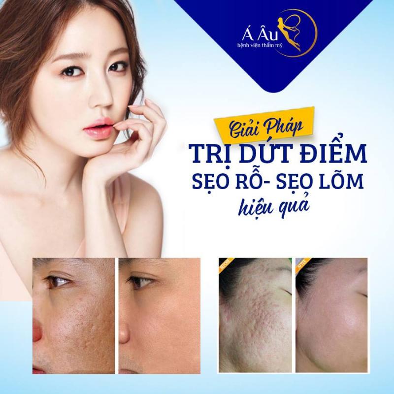 Bệnh Viện Thẩm Mỹ Á Âu