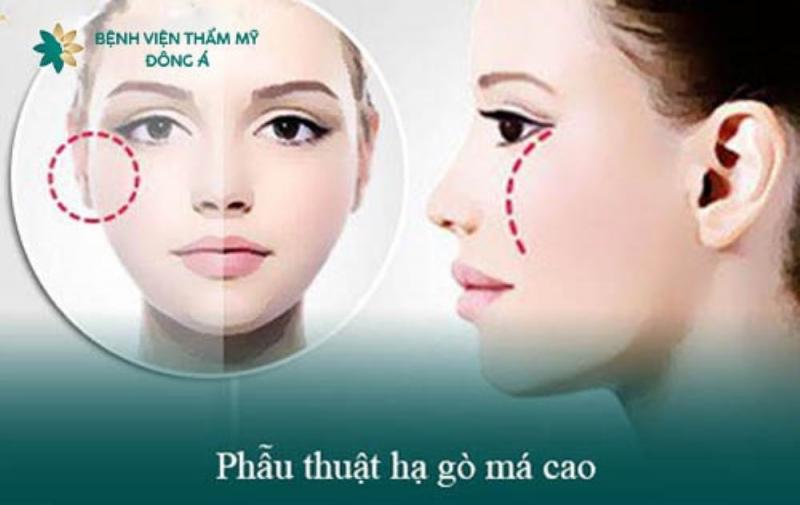 Bệnh Viện Thẩm Mỹ Đông Á