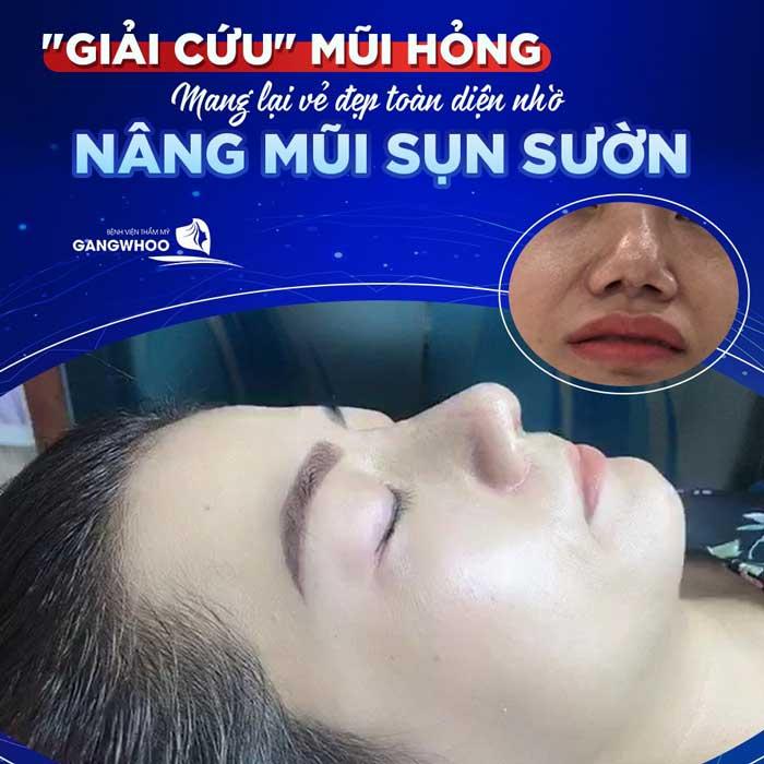 Bệnh viện thẩm mỹ Gangwhoo