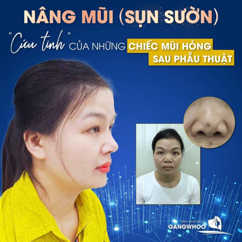 Bệnh viện thẩm mỹ Gangwhoo