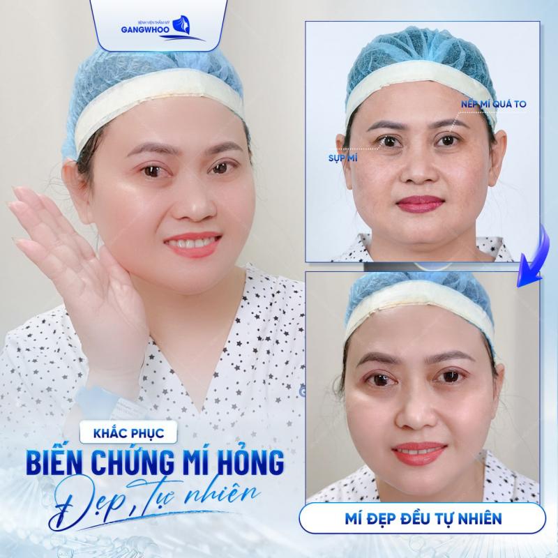 Bệnh viện thẩm mỹ Gangwhoo