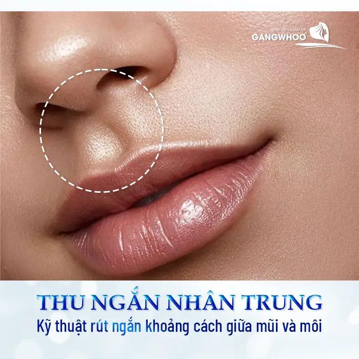 Bệnh Viện Thẩm Mỹ Gangwhoo