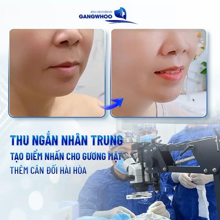 Bệnh Viện Thẩm Mỹ Gangwhoo