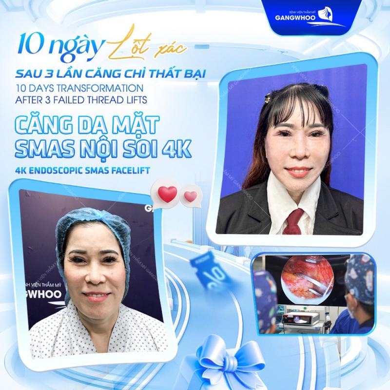 Bệnh viện thẩm mỹ Gangwhoo