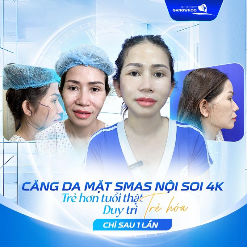 Bệnh viện thẩm mỹ Gangwhoo