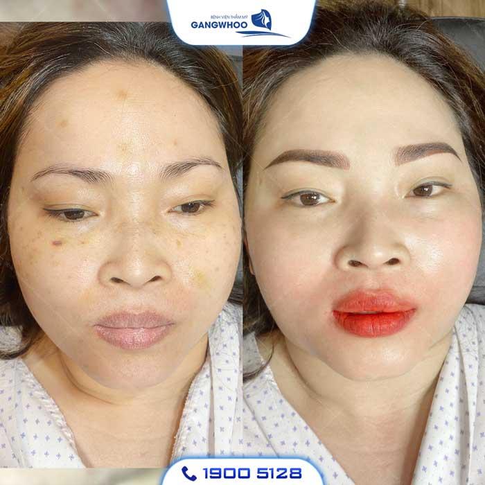 Bệnh viện thẩm mỹ Gangwhoo