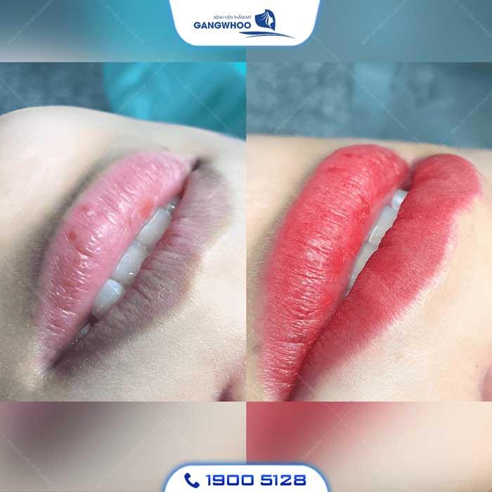 Bệnh viện thẩm mỹ Gangwhoo