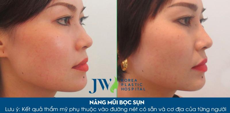 Bệnh viện thẩm mỹ JW