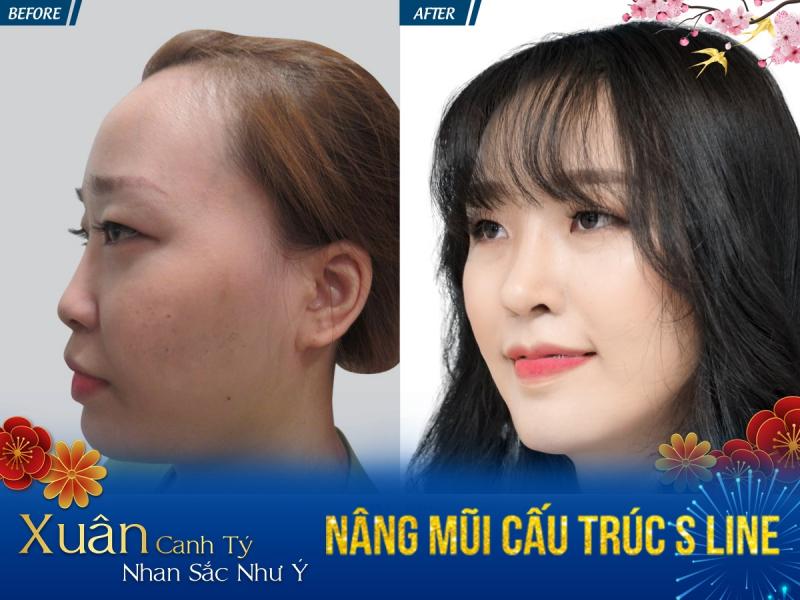 Bệnh Viện Thẩm Mỹ Jw Hàn Quốc