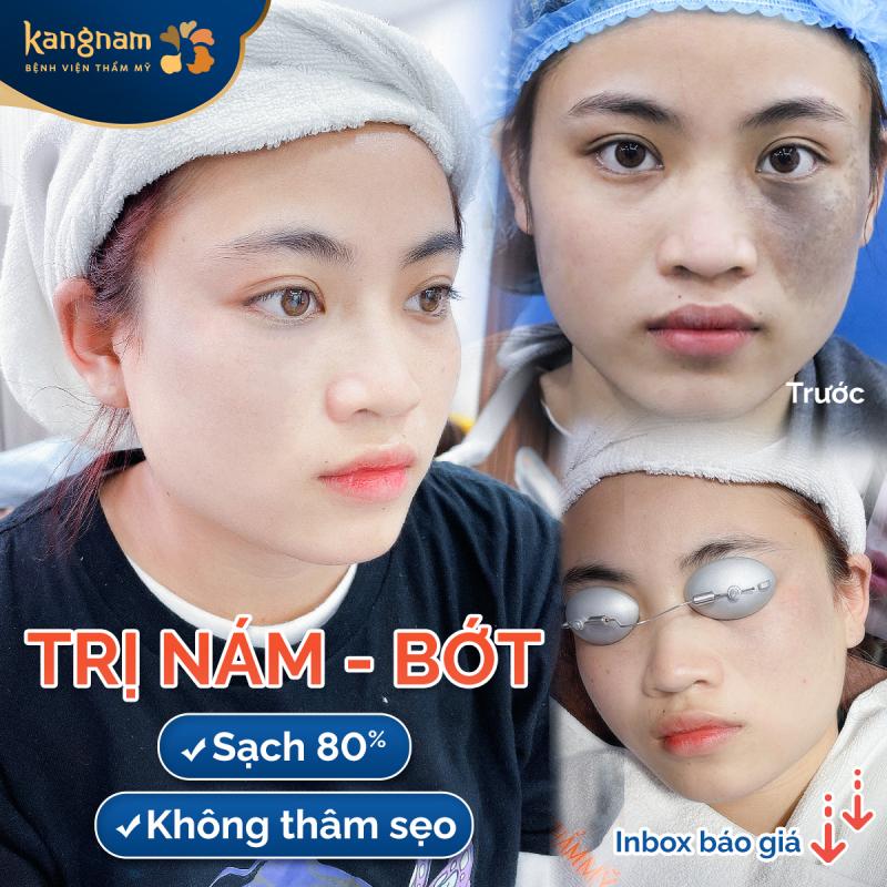 Bệnh viện thẩm mỹ Kangnam