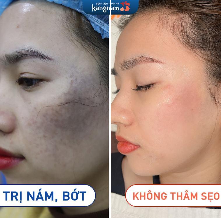 Bệnh viện thẩm mỹ Kangnam