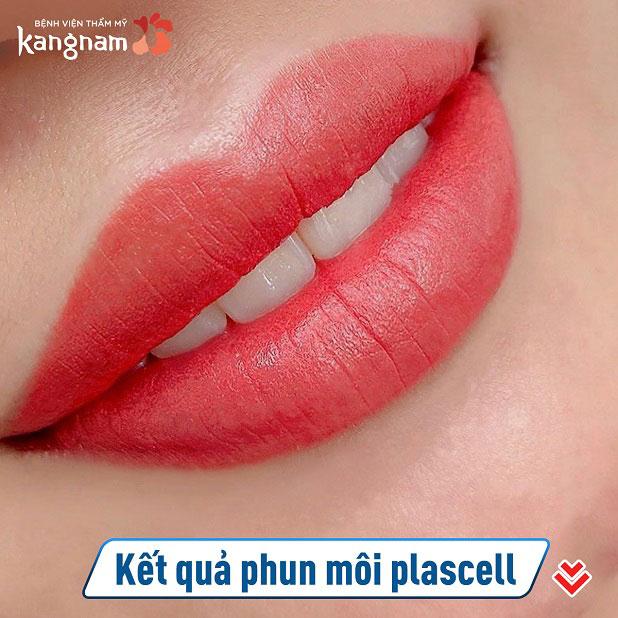 Bệnh viện thẩm mỹ Kangnam