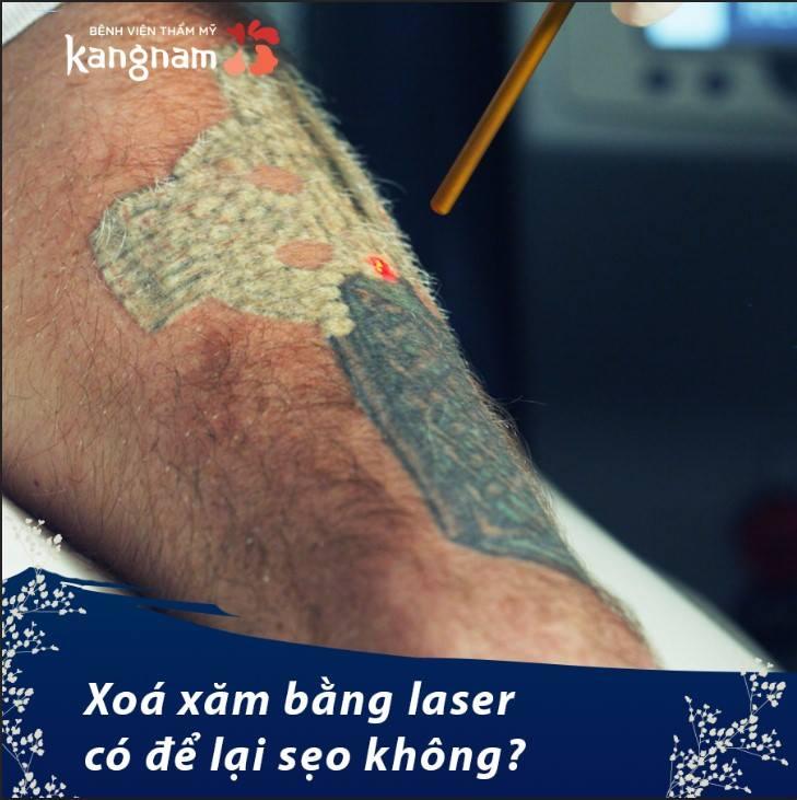 Bệnh viện thẩm mỹ Kangnam