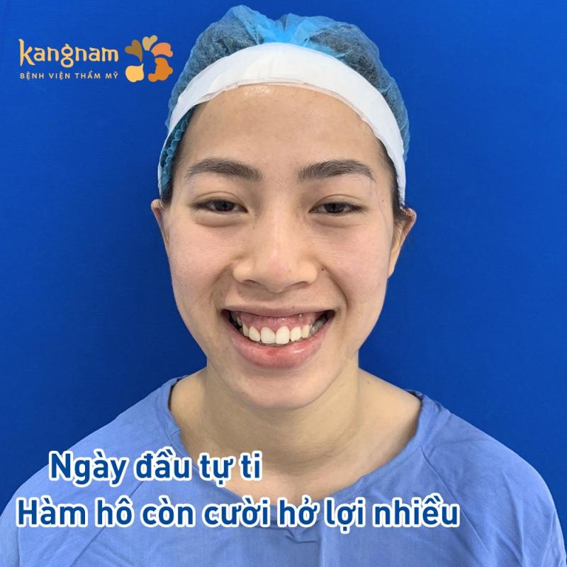 Bệnh viện Thẩm mỹ Kangnam